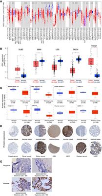 A pan-cancer analysis of the role of argininosuccinate synthase 1 in human tumors